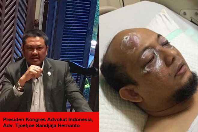 KAI Kutuk Keras Aksi Teror Pada Novel Baswedan Serta Para Penegak Hukum Lainnya